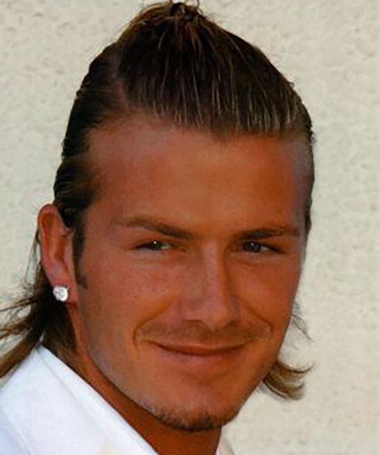 Did David Beckham Get a Hair Transplant