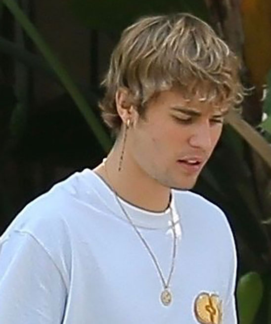 Justin Bieber Hair Loss