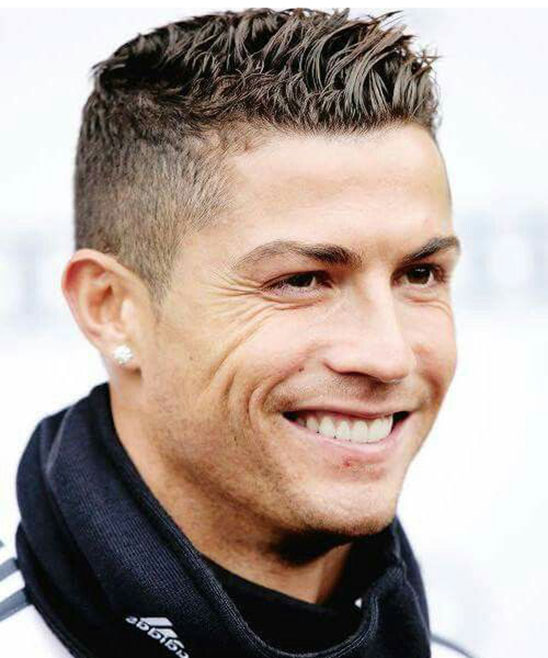 Ronaldo Hair Transplant