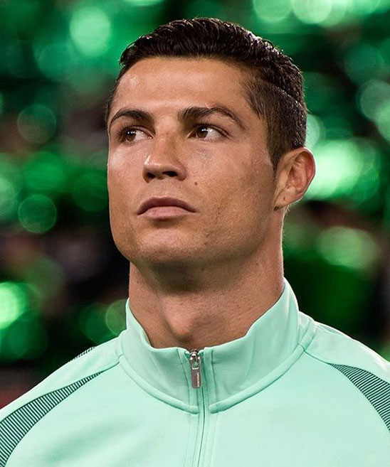 Ronaldo, Hypothyroidism and Hair Loss